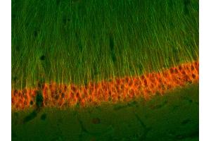 Immunohistochemistry (IHC) image for anti-alpha Tubulin (TUBA1) (AA 443-449) antibody (ABIN1742550) (alpha Tubulin Antikörper  (AA 443-449))