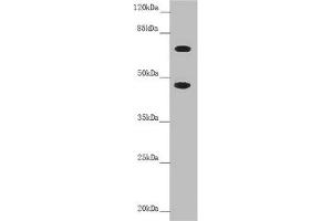Western blot All lanes: SLC39A4 antibody at 4. (SLC39A4 Antikörper  (AA 23-327))