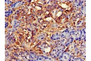 Immunohistochemistry of paraffin-embedded human pancreatic tissue using ABIN7145827 at dilution of 1:100 (TNFAIP1 Antikörper  (AA 233-316))