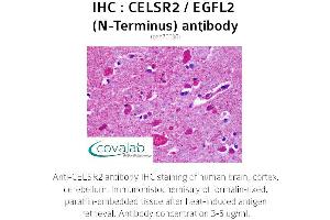 Image no. 2 for anti-Cadherin EGF LAG Seven Pass G-Type Receptor 2 (CELSR2) (Extracellular Domain), (N-Term) antibody (ABIN1732970) (CELSR2 Antikörper  (Extracellular Domain, N-Term))