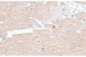 Immunohistochemistry of paraffin-embedded Rat heart using ABCB7 Polyclonal Antibody at dilution of 1:100 (40x lens). (ABCB7 Antikörper)