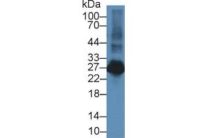 Western Blot; Sample: Rat Spleen lysate; Primary Ab: 2µg/ml Rabbit Anti-Rat LAT2 Antibody Second Ab: 0. (LAT2 Antikörper  (AA 32-192))