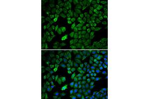 Immunofluorescence analysis of U2OS cells using PRMT5 antibody. (PRMT5 Antikörper)