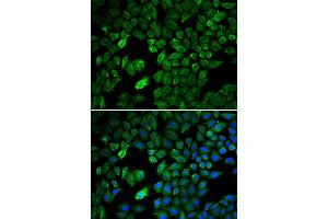 Immunofluorescence analysis of U2OS cells using PRMT5 antibody. (PRMT5 Antikörper)