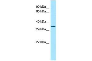 WB Suggested Anti-Atf5 Antibody Titration: 1. (ATF5 Antikörper  (C-Term))