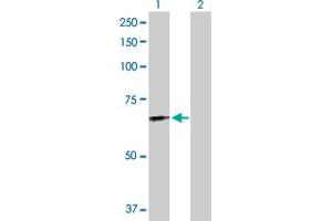 Western Blot analysis of FGL2 expression in transfected 293T cell line by FGL2 MaxPab polyclonal antibody. (FGL2 Antikörper  (AA 1-439))