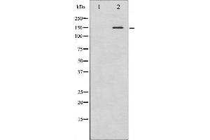 Western blot analysis of Bcr phosphorylation expression in COS7 whole cell lysates,The lane on the left is treated with the antigen-specific peptide. (BCR Antikörper  (pTyr360))