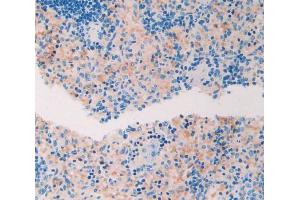 Immunohistochemistry (IHC) image for anti-ADAM Metallopeptidase with Thrombospondin Type 1 Motif, 1 (ADAMTS1) (AA 476-614) antibody (ABIN1175279)