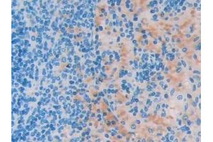 Immunohistochemistry (IHC) image for anti-Uncoupling Protein 2 (Mitochondrial, Proton Carrier) (UCP2) (AA 99-216) antibody (ABIN7435031)