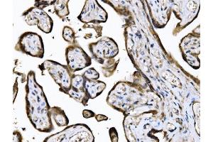 IHC analysis of KIF2A using anti-KIF2A antibody (ABIN7600510). (KIF2A Antikörper  (AA 2-706))