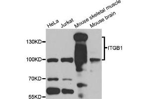 Western blot analysis of extracts of various cell lines, using ITGB1 antibody (ABIN6003513) at 1/1000 dilution. (ITGB1 Antikörper)