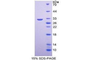 SDS-PAGE (SDS) image for Collagen, Type IV, alpha 5 (COL4A5) (AA 1461-1685) protein (His tag) (ABIN1098973)