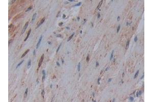 Detection of COX-1 in Human Rectum Tissue using Polyclonal Antibody to Cyclooxygenase 1 (COX-1) (COX-1 Antikörper  (AA 367-599))
