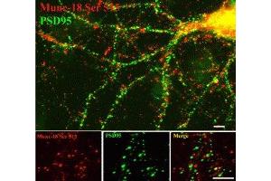 Immunostaining of 14 DIV rat cortical neurons showing specific labeling of Munc-18 phosphorylated at Ser513 (red) and PSD95 (green). (STXBP2 Antikörper  (pSer513))