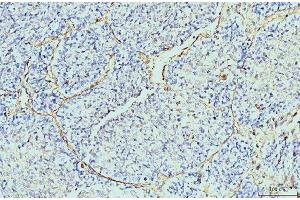 IHC analysis of Annexin VI using anti-Annexin VI antibody (ABIN7601597).