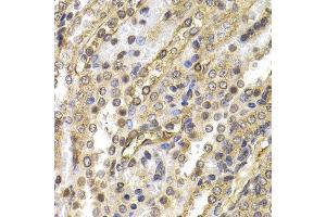 Immunohistochemistry (IHC) image for anti-Neural Precursor Cell Expressed, Developmentally Down-Regulated 9 (NEDD9) (AA 60-174) antibody (ABIN6219606) (NEDD9 Antikörper  (AA 60-174))