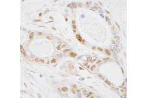 Immunohistochemistry (IHC) image for anti-Pseudouridylate Synthase 1 (PUS1) (AA 377-427) antibody (ABIN7448747) (PUS1 Antikörper  (AA 377-427))