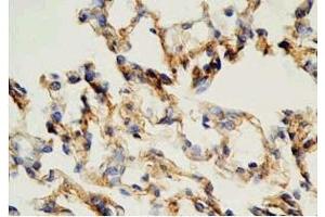 Rat lung tissue was stained by Rabbit Anti-AdrenomeduIIiln (1-44) (Human) Antibody (Adrenomedullin Antikörper  (AA 1-44))