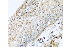 Immunohistochemistry of paraffin-embedded Human esophagus using NDUFA2 Polyclonal Antibody at dilution of 1:100 (40x lens). (NDUFA2 Antikörper)