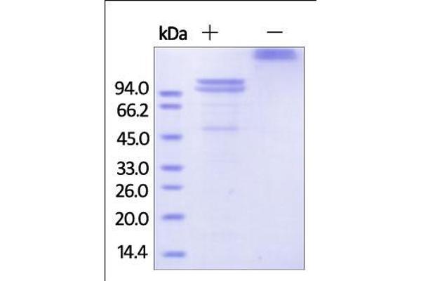 E-cadherin Protein (AA 23-621) (Fc Tag)