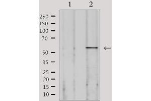 Western blot analysis of extracts from 293, using SPAM1 Antibody. (SPAM1 Antikörper  (Internal Region))