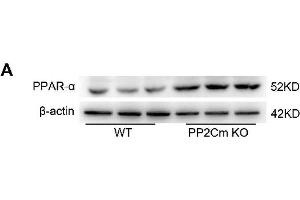 Exacerbated I/R injury in the PP2Cm KO heart is rescued by PPAR-α knockdown.