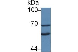 Detection of KL in Rat Liver lysate using Polyclonal Antibody to Klotho (KL) (Klotho Antikörper  (AA 517-956))