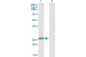 Western Blot analysis of NFAM1 expression in transfected 293T cell line by NFAM1 monoclonal antibody (M10), clone 2E9. (NFAM1 Antikörper  (AA 187-269))