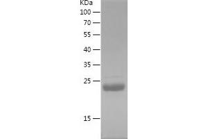 Western Blotting (WB) image for Thymidine Kinase 1, Soluble (TK1) (AA 2-234) protein (His tag) (ABIN7125381) (TK1 Protein (AA 2-234) (His tag))