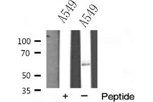 Western blot analysis of FAST kinase expression in A549 cells (FASTK Antikörper  (Internal Region))
