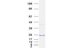 Validation with Western Blot (RAB32 Protein (Myc-DYKDDDDK Tag))