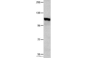 Western blot analysis of K652 cell , using IDE Polyclonal Antibody at dilution of 1:350 (IDE Antikörper)