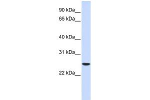 WB Suggested Anti-UBE2K Antibody Titration: 0. (UBE2K Antikörper  (Middle Region))