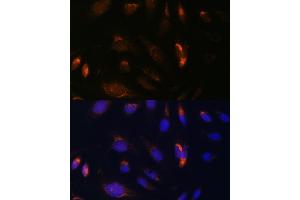 Immunofluorescence analysis of U-2 OS cells using CHUK antibody (ABIN3022824, ABIN3022825, ABIN3022826 and ABIN6219246) at dilution of 1:100. (IKK alpha Antikörper  (C-Term))