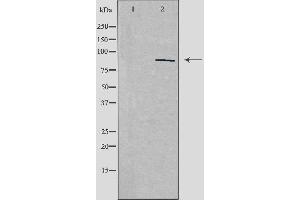 Western blot analysis of extracts from HepG2 cells, using ZNF148 antibody. (ZNF148 Antikörper  (N-Term))