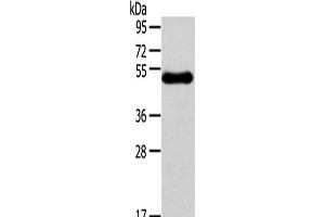 Western Blot analysis of Human breast infiltRative duct tissue using RHCE Polyclonal Antibody at dilution of 1/250