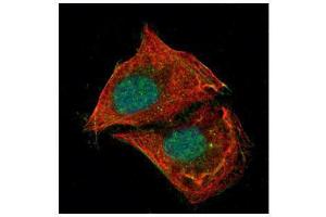 ICC/IF Image Confocal immunofluorescence analysis (Olympus FV10i) of paraformaldehyde-fixed U2OS, using p53, antibody (Green) at 1:500 dilution. (p53 Antikörper  (N-Term))