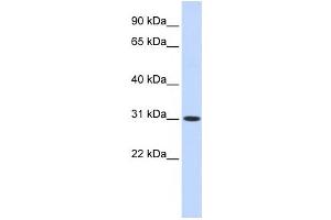 Western Blotting (WB) image for anti-Cytochrome B5 Domain Containing 2 (CYB5D2) antibody (ABIN2459562)