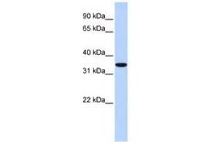 Image no. 1 for anti-Membrane-Associated Ring Finger (C3HC4) 1, E3 Ubiquitin Protein Ligase (MARCH1) (AA 36-85) antibody (ABIN6740805)