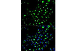 Immunofluorescence analysis of A549 cell using AK4 antibody. (AK4 Antikörper)