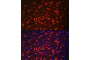 Immunofluorescence analysis of rat brain using TRPM2 antibody (ABIN6128836, ABIN6149582, ABIN6149583 and ABIN6221738) at dilution of 1:100.