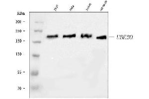 Western blot analysis of UBE2O using anti-UBE2O antibody (ABIN7600121).