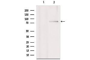 Western blot analysis of extracts from various samples, using RNF6 Antibody.