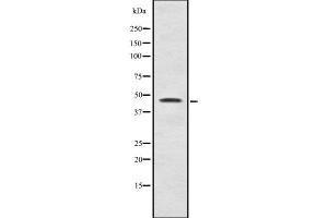 Western blot analysis Sox-11 using LOVO whole cell lysates (SOX11 Antikörper  (C-Term))