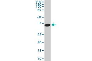 PGGT1B monoclonal antibody (M02), clone 5E4. (PGGT1B Antikörper  (AA 1-105))