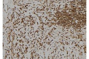 ABIN6273385 at 1/100 staining Human gastric tissue by IHC-P. (RFPL1 Antikörper  (Internal Region))