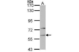 WB Image Sample (30 ug of whole cell lysate) A: 293T 7. (Phenylalanyl-tRNA Synthetase, alpha Subunit (FARSA) Antikörper)