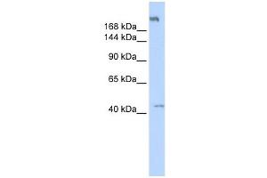 POLR3A antibody used at 1 ug/ml to detect target protein. (POLR3A Antikörper  (Middle Region))