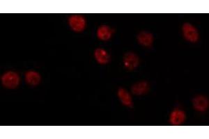ABIN6266786 staining HT29 by IF/ICC. (MED17 Antikörper  (Internal Region))