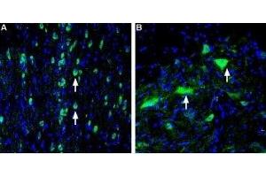 Expression of VAChT in rat medial septum and spinal cord - Immunohistochemical staining of perfusion-fixed frozen rat brain sections using Anti-Vesicular Acetylcholine Transporter (VAChT) Antibody (ABIN7043686, ABIN7044219 and ABIN7044220), (1:400), followed by goat-anti-rabbit-AlexaFluor-488. (SLC18A3 Antikörper  (C-Term, Cytosolic))